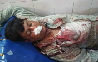 নরসিংদীতে এসএ টিভির সাংবাদিকের উপর চেয়ারম্যানের হামলা