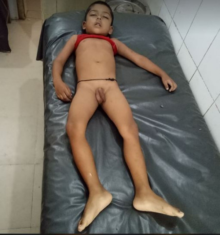 সদরপুরে ১ দিনের ব্যবধানে পানিতে ডুবে আবারো শিশুর মৃত্যু 