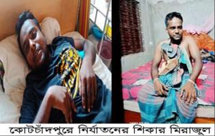 কোটচাঁদপুরে মিথ্যা চুরির অভিযোগে দিনমজুরকে হাতুড়ি দিয়ে পিটিয়ে জখম, থানায় অভিযোগ দায়ের