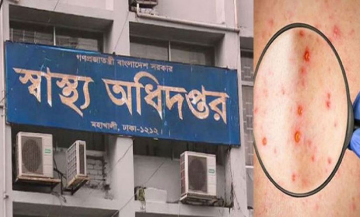 মাঙ্কিপক্স রোধে বন্দরে বন্দরে সতর্কতা