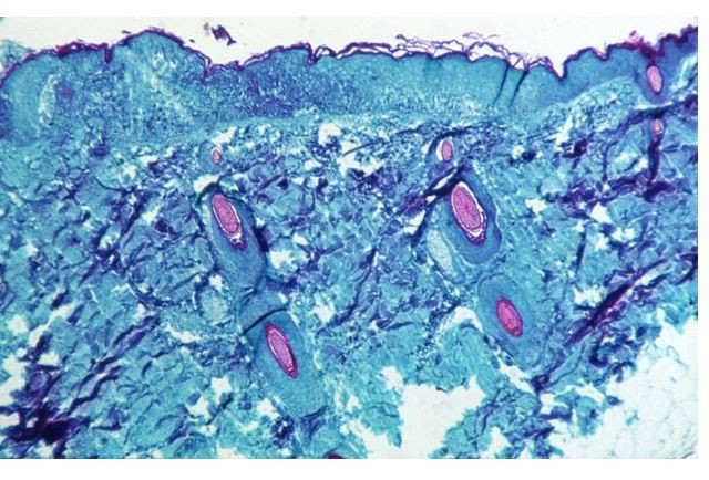 আক্রান্ত বাড়লেও মাঙ্কিপক্স নিয়ন্ত্রণে রাখা সম্ভব: ডব্লিউএইচও