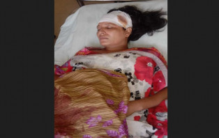 সদরপুরে ইউ'পি সদস্যাকে পিটিয়ে জখম, হাসপাতালে ভর্তি