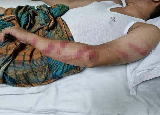 দুই ঘণ্টা বাসে আটকে রেখে ছাত্রদল কর্মীকে মারধরের অভিযোগ 