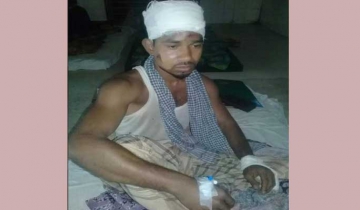 সালথায় যুবকের ওপর প্রতিপক্ষের অতর্কিত হামলা